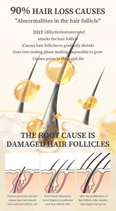 Champú Anticaída con ADN y <span class=keywords><strong>Glicerina</strong></span> de Sodio, Natural a Base de Hierbas para el Crecimiento del Cabello, Fortalece las Raíces, Controla la Grasa y Anticaspa, 30ml - Product Image 5