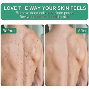 Gants exfoliants pour le bain pour éliminer les peaux mortes, gommage corporel pour le bain, gants exfoliants réutilisables pour autobronzant, emballage personnalisé avec logo - Product Image 6