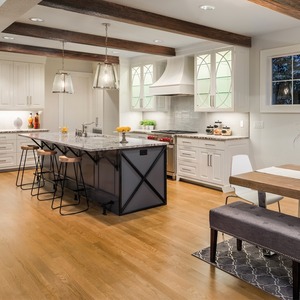 แม่พิมพ์เนื้อฟันเรียบผลิตจาก PU โรงงานจีน - Product Image 3