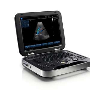 Échographe vétérinaire portable pour chiens et petits animaux, rechargeable par USB, certifié CE, garantie de 2 ans - Product Image 1