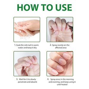 Marque privée Nouveauté 2025 Spray <span class=keywords><strong>antifongique</strong></span> pour ongles 7 jours Répare les dommages aux ongles et aux cuticules Produits <span class=keywords><strong>de</strong></span> soin <span class=keywords><strong>de</strong></span> la peau 30ml MOOYAM Spray pour ongles - Product Image 6