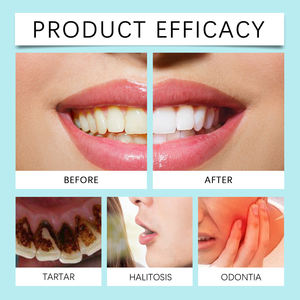 Oralhoe Daily Care Mint Blanqueamiento Líquido Enjuague bucal <span class=keywords><strong>Aliento</strong></span> fresco y manchas de dientes Limpieza refrescante de dientes Eliminación de olores orales - Product Image 6