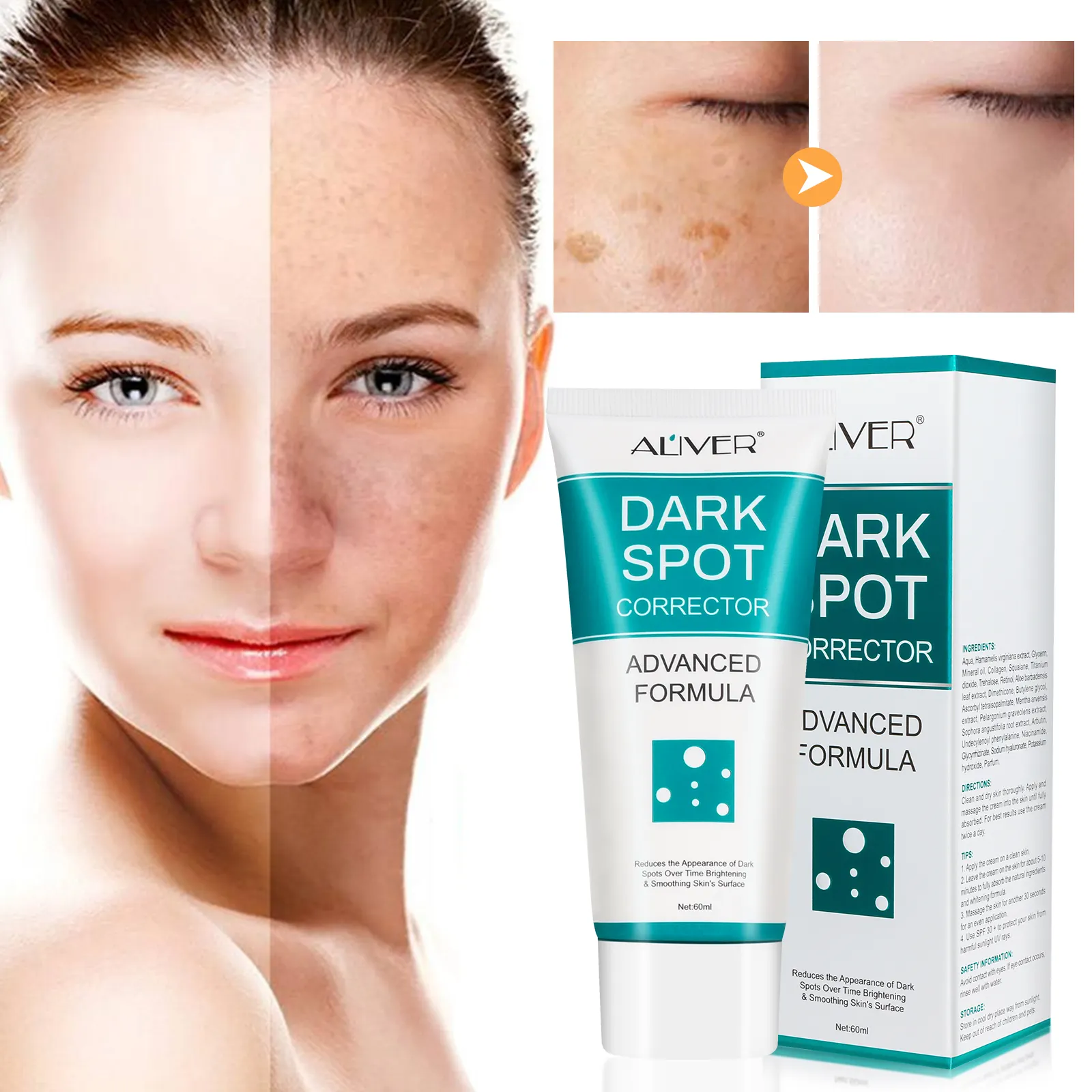 ALIVER Cuidado de la piel facial Corrector de manchas oscuras Crema para eliminar manchas de melanina y pecas Crema para blanquear la piel suavizante nutritiva