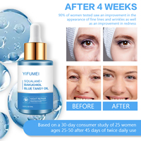 Squalane Bakuchiol Blue Tansy Night Repair Liquid Anti-âge Éclaircissant Raffermissant Réducteur de Rides 30mL OEM en Gros