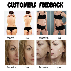 Máquina de Terapia Tecar, Fisioterapia <span class=keywords><strong>Indiba</strong></span> 448KHz, Terapia Tecar Fascial, Máquina de Terapia Veterinaria - Product Image 6