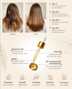 Minyak esensial ekstrak tanaman, minyak esensial Rosemary meningkatkan kesehatan kulit kepala melawan bakteri dan peradangan meringankan nyeri otot - Product Image 4