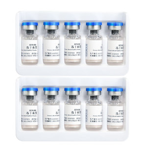 포도상 구균 응고 효소 시험 배양 매체를위한 동결 건조 토끼 혈장 보충 - Product Image 1