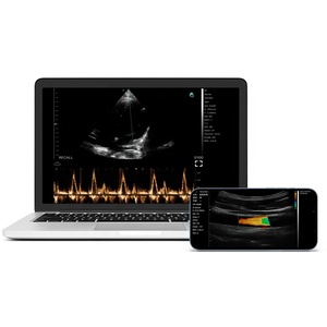 Sonda de Ultrasonido Inalámbrica Viatom C10 de 128 Elementos, Ultrasonido Portátil Inalámbrico con Doppler a Color 3 en 1 - Product Image 4