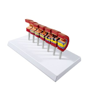 Modelo de Enseñanza de Anatomía Humana para Ciencias Médicas: Pie Diabético para Educación en Endocrinología y Patofisiología, Escuela de Medicina - Product Image 4