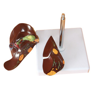 Model Lesi Hati Manusia Struktur Portal Hati Lobus Hati Peralatan Pengajaran Ilmu Kedokteran Model Anatomi - Product Image 3