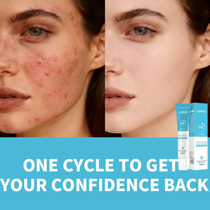 Crema Notte Anti-<span class=keywords><strong>Acne</strong></span> OEM che Attenua le Macchie dell'<span class=keywords><strong>Acne</strong></span>, Rimuove l'<span class=keywords><strong>Acne</strong></span>, Chiude e Restringe i Pori, Arricchita con <span class=keywords><strong>Acido</strong></span> <span class=keywords><strong>Salicilico</strong></span> ed Essenza Vegetale, per Tutti i Tipi di Pelle - Product Image 2