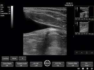 Draagbare Ultrasound Machine Medische Usg Pw Cw Dicom Cardiale Sonde Cardiologie Voor Ziekenhuis Kliniek
