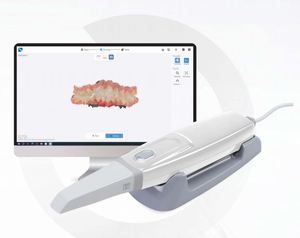 Escáner Intraoral Dental 3D a Color Real con IA, Puntas Autoclavables, Compartición en la Nube, Compatible con <span class=keywords><strong>Exocad</strong></span>, Escáner de Impresión Digital Oral - Product Image 4