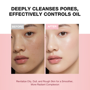 <span class=keywords><strong>Nettoyant</strong></span> Gommage Éclaircissant à l'<span class=keywords><strong>Acide</strong></span> <span class=keywords><strong>Salicylique</strong></span> et Céramide Purifie en Profondeur Contrôle du Sébum à la Vitamine C et Niacinamide - Product Image 3