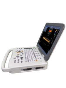 Siêu âm DOPPLER màu siêu âm bác sĩ thú y ultrasonido thiết bị hệ thống di động thú y máy siêu âm Máy quét - Product Image 3