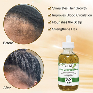 Huile <span class=keywords><strong>de</strong></span> Massage Capillaire Personnalisée Bio et Végane à Base <span class=keywords><strong>de</strong></span> Plantes, Fortifiante pour le Cuir Chevelu, <span class=keywords><strong>Infusion</strong></span> <span class=keywords><strong>Romarin</strong></span>, Menthe et Ricin pour une Croissance Extrême des Cheveux - Product Image 5
