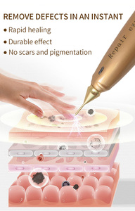 เครื่องบำบัดผิวหน้าด้วยไอออนเย็นขั้นสูง ระบบวอร์เท็กซ์ ช่วยฟื้นฟูผิว ลดเลือนริ้วรอย ดูแลผิวแพ้ง่าย พร้อมหัวจับ 2 หัว - Product Image 4