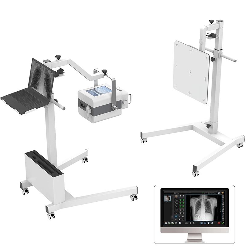 Equipo de diagnóstico de radiología médica, máquina de rayos X Digital portátil de alta frecuencia de 5Kw/8Kw