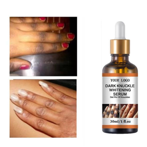Serum exfoliante personalizable, pequeño, para piel opaca, pigmento negro, exfoliante de manos, tobillos, rodillas, suero para despegar - Product Image 4