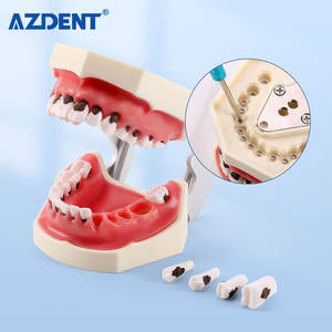 <span class=keywords><strong>Model</strong></span> Pengajaran Gigi Azdent <span class=keywords><strong>Model</strong></span> Kalkulus Gigi/ <span class=keywords><strong>Model</strong></span> Penyakit <span class=keywords><strong>Periodontal</strong></span> - Product Image 6