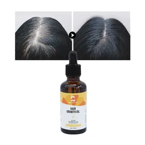 Free Samples Custom Own Brand Hair Growth Oil With Biotin And Castor Fast Hair Growth Oil For Woman