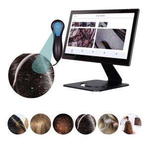 Instrumento de Detección Capilar con Software Estable de Alta Velocidad para el <span class=keywords><strong>Estado</strong></span> de Salud del Cuero Cabelludo con IA - Product Image 2