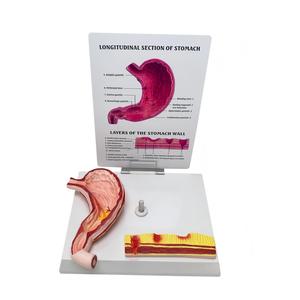 แบบจำลองกายวิภาคกระเพาะอาหารมนุษย์พร้อมโรคภูมิภาคนิยมพบกัน ตัดตามยาว สำหรับ<span class=keywords><strong>การ</strong></span>สอนทาง<span class=keywords><strong>การ</strong></span>แพทย์ - Product Image 5