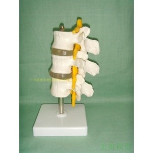 Modèle de colonne lombaire normale combiné ; Modèle de colonne lombaire en 3 sections ; Modèle de colonne lombaire en 3 sections ; Modèle de colonne lombaire en 4 sections - Product Image 5