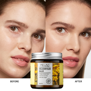 Bálsamo Reparador, Nutrición Profunda, Recuperación de la Barrera Cutánea, Cuidado Calmante, Hidratante, Reparación de la Piel, 100g, Bálsamo de Helichrysum - Product Image 4