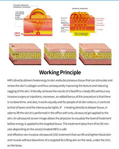 เครื่อง Hifu 7 มิติ แบบตั้งโต๊ะ ยกกระชับใบหน้าและผิวกาย แปรงทำความสะอาดผิวหน้าความเข้มข้นสูง ช่วยให้ผิวกระชับ ลดเลือนริ้วรอย - Product Image 4