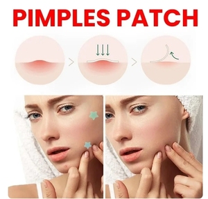 Parche reparador para acné, cuidado facial de la piel, manchas que se desvanecen, marcas de espinillas, cubierta cerrada para manchas de acné, parche de reparación de espinillas - Product Image 3