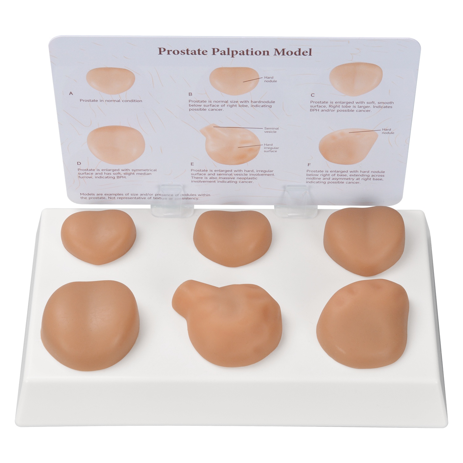 Meniscus Suture Model Life Size Human Demilune Menisci Medical Science Teaching Tool Anatomical Model 058c6b80 A108 41de Bf95 1ac58ebf09ae 800x