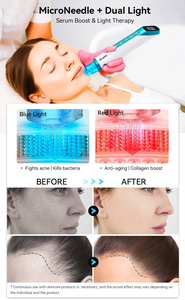 <span class=keywords><strong>Dr</strong></span> <span class=keywords><strong>Pen</strong></span> H6 Smart <span class=keywords><strong>Microneedling</strong></span> Hydra <span class=keywords><strong>Pen</strong></span>, infusion de sérum, thérapie par lumière rouge et bleue pour le rajeunissement de la peau - Product Image 3