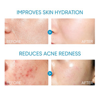Réparation de la peau du visage Dissolvant anti-rides Mosturizer Crème de pansement noire pour le visage