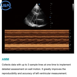 Échographe vétérinaire hospitalier avec TDI TEE Cardiaque MQA SonoScape ProPet 80 pour l'imagerie diagnostique myocardique des petits animaux - Product Image 3