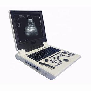 Pemindai <span class=keywords><strong>Ultrasound</strong></span> <span class=keywords><strong>Laptop</strong></span> convex probe dan mesin <span class=keywords><strong>ultrasound</strong></span> layar LED linear probe dengan 2 konektor probe - Product Image 4