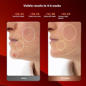 Cross-Border Home-Use LED <strong>Light</strong> <strong>Therapy</strong> Beauty Mask New Photon Rejuvenation Device <strong>Red</strong> Blue Large Panel Electronic <strong>Accessories</strong> - Product Image 4