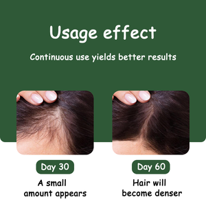 Lozione per la Crescita dei Capelli, Prodotto Anticaduta, Spray Olio per Capelli, Fornitore all'Ingrosso di Fabbrica Originale, Prezzo Basso OEM - Product Image 3