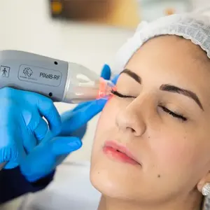 Cartouche de <span class=keywords><strong>radiofréquence</strong></span> <span class=keywords><strong>fractionnée</strong></span> et <span class=keywords><strong>micro</strong></span>-aiguilleuse RF pour la vente - Product Image 5