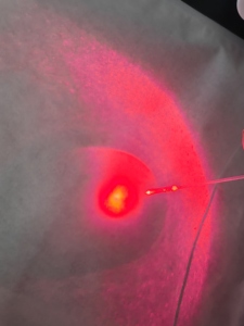 Hospital Proctólogo Pilas Hemorroides Fístula Tratamiento de proctología 980 nm 1470nm Láser quirúrgico 1470nm Pilas - Product Image 6