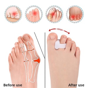 <span class=keywords><strong>Orthèse</strong></span> à trou unique pour <span class=keywords><strong>hallux</strong></span> <span class=keywords><strong>valgus</strong></span>, séparateur d'orteils superposés, manchon séparateur d'orteils en SEBS, correcteur d'<span class=keywords><strong>hallux</strong></span> <span class=keywords><strong>valgus</strong></span>, taille unique, en stock - Product Image 4
