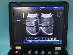 Ultrasonido 3D portátil para <span class=keywords><strong>centro</strong></span> <span class=keywords><strong>de</strong></span> imágenes <span class=keywords><strong>de</strong></span> diagnóstico médico con ultrasonido <span class=keywords><strong>de</strong></span> Color Humano veterinario para Ginecología - Product Image 3