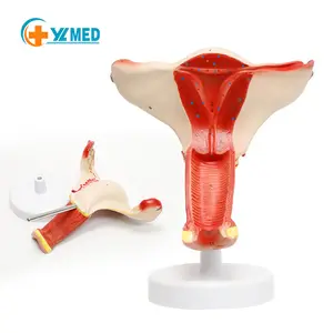 Science médicale Modèle d'utérus féminin Aides pédagogiques médicales gynécologiques Modèle pathologique d'ovaire vaginal féminin utilisé dans l'enseignement