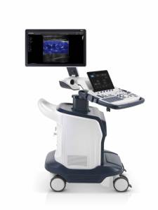 Sonosape-Soporte doppler S60 para coche, <span class=keywords><strong>precio</strong></span> de ultrasonido, sonosape, sonosape s60 - Product Image 5