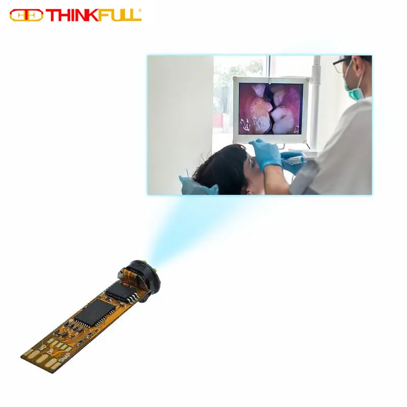 치과 감지 무료 드라이버 2mp 1080P 7mm 통합 의료 내시경 카메라 모듈 USB 출력 8pcs led