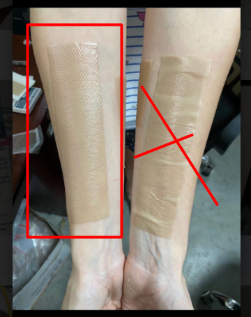 product-306-387 High Quality Factory Direct Supplier Medical Silicone Gel Dressing Sheet For Scar Reducing Silicone Scar Tape