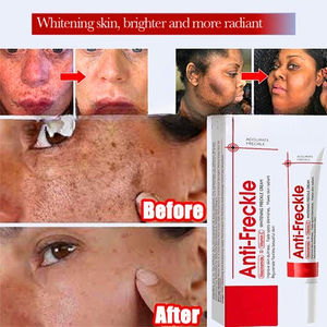 Crema Facial Iluminadora con Niacinamida 20g Ayuda a Mejorar el Tono de la Piel y Reducir la Apariencia de Manchas Oscuras y Pigmentación Desigual - Product Image 2