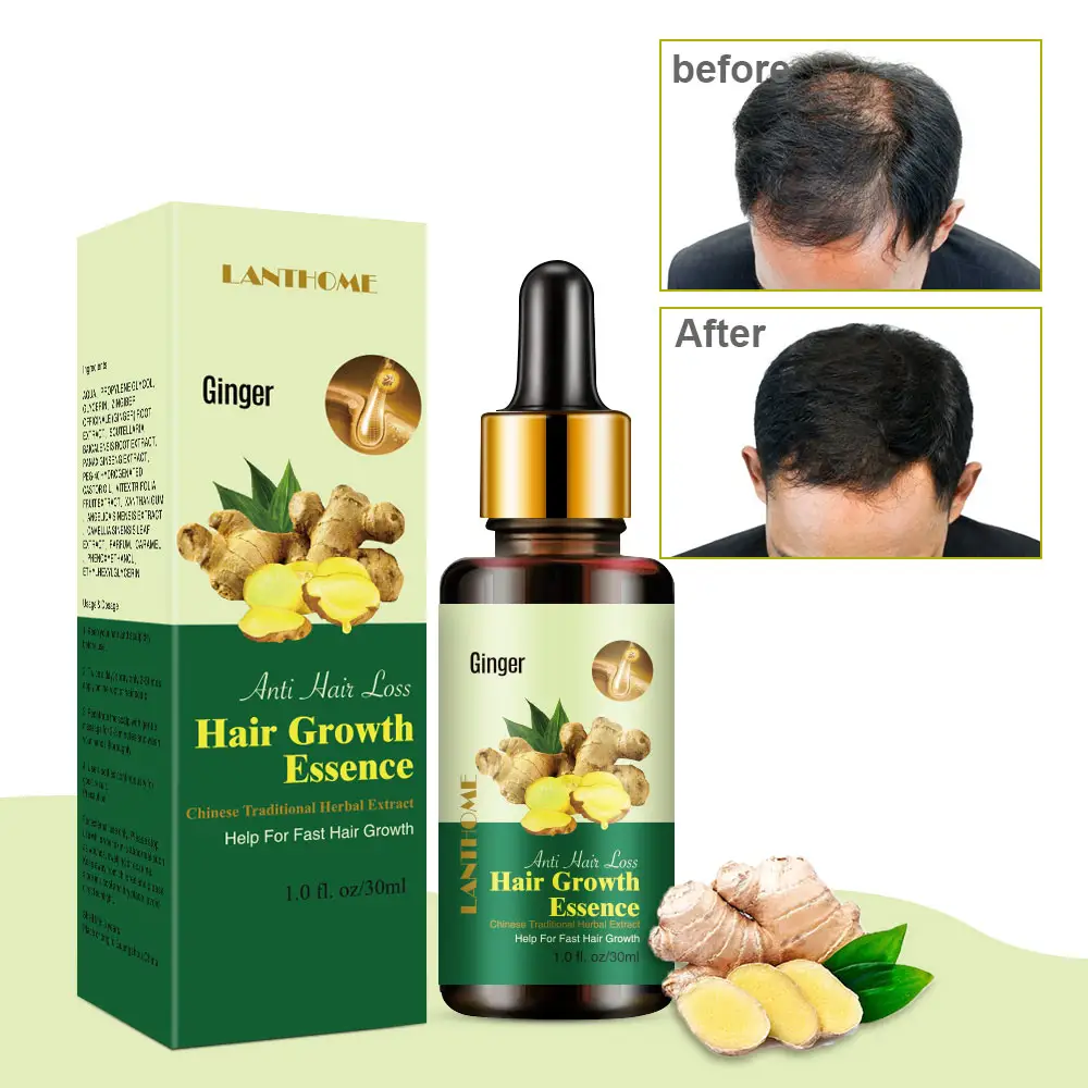 Marca OEM ODM Tratamento da Perda de Cabelo Crescerem 7 Dias Gengibre Germinativo Óleo Natural O Crescimento Orgânico Óleo de Crescimento Do Cabelo Para Homens e Mulheres