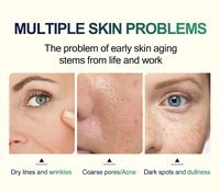 Offre Spéciale avancé rajeunissant pour la peau 40% 45% 50% Sérums pour le visage Peel adoucit les cicatrices blanchissant le sérum liquide pour le visage