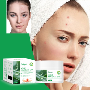 Crema Hidratante de <span class=keywords><strong>Aloe</strong></span> <span class=keywords><strong>Vera</strong></span> Natural Zaleyae, Desvanece Manchas, Antiacné, Reduce Poros, Nutre, Repara, Rejuvenece, Gel para el Cuidado Facial - Product Image 3